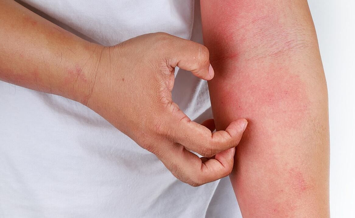 komplikasi mungkin tina pamakéan soda